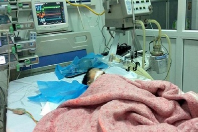 Bé 8 tháng tuổi bị tiêm nhầm thuốc có dấu hiệu bị chết não