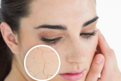 Cách ngăn ngừa và chăm sóc da nhạy cảm