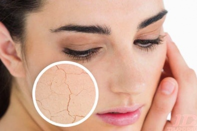 Mẹo trị da khô nứt nẻ hiệu quả nhất ngay tại nhà