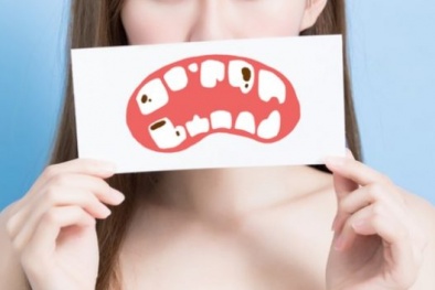 Sức khỏe răng miệng kém làm tăng nguy cơ tử vong