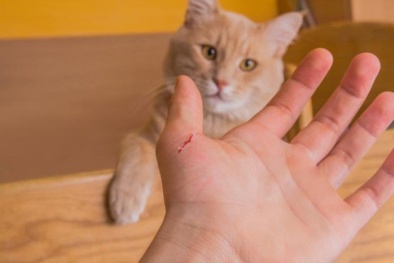 Tổn thương não, nhiễm trùng tim vì bị mèo cắn trong lúc chơi