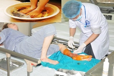 Người tiểu đường phải cắt cụt chi vì dùng thuốc lá ngâm chân