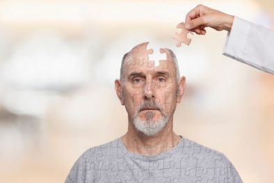 Thường xuyên buồn ngủ vào ban ngày có thể là dấu hiệu của bệnh Alzheimer
