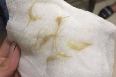 Em nhỏ gặp nguy kịch khi nuốt phải giấy ăn