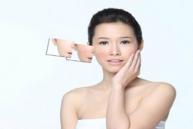 Tuyệt chiêu trị mụn cấp tốc để đi du lịch dịp 30/4 chỉ với vài nghìn đồng