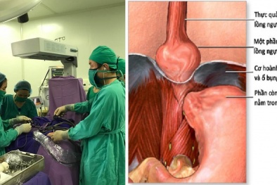 Mẹ bầu cảnh giác với căn bệnh khiến dạ dày, quai ruột 'chui nhầm' lên phổi ở trẻ nhỏ
