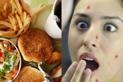Đừng dại mà ăn nhiều thực phẩm này vào mùa hè nếu không muốn 'rước họa'