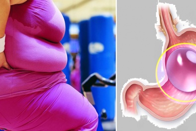 Thêm 5 người tử vong vì bong bóng giảm cân