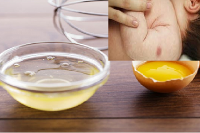 Tính mạng trẻ bị đe dọa nếu đi tiêm chủng về mẹ làm điều này!