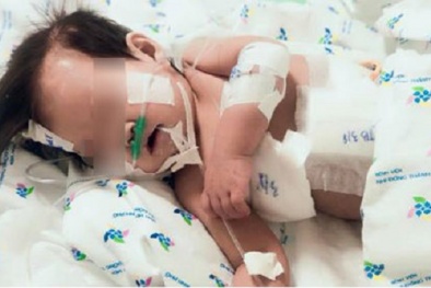 Chăm con theo cách này, bà mẹ trẻ khiến bé gái nguy kịch vì kháng tất cả kháng sinh