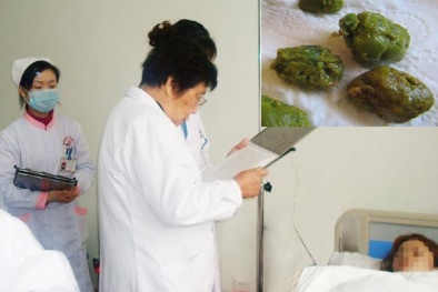 Ăn chay để giảm cân cô gái nhận 'cái kết đắng' phải cắt túi mật