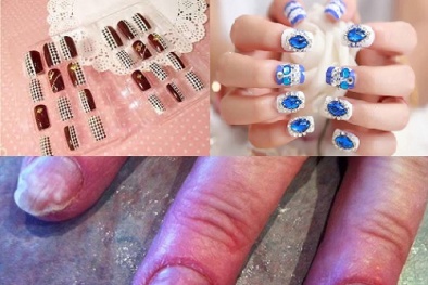 Chuyên gia cảnh báo: Gắn móng tay giả độc hại không kém khi sơn trực tiếp