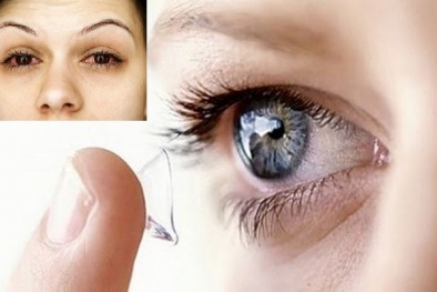 Cảnh báo: Đeo kính áp tròng đi ngủ thường xuyên có thể gây mù lòa vĩnh viễn