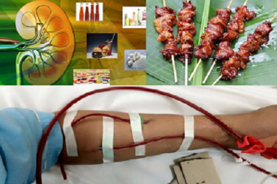 Dùng nhiều nước sốt trong chế biến thức ăn có thể gây suy thận