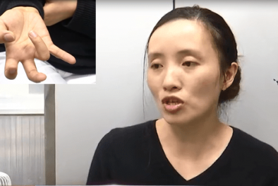 Chơi game liên tục trên điện thoại có thể gây liệt ngón tay