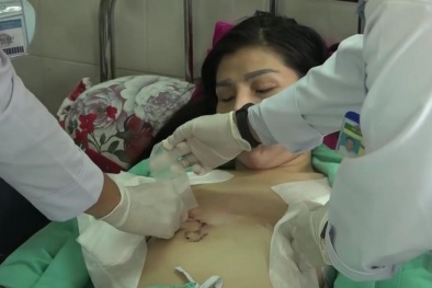 Tiêm filler làm đầy, cô gái bị hoại tử ngực
