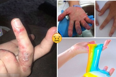 Chất nhờn ma quái - trò chơi mang đầy hiểm họa