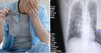 Thói quen ngửi tất bẩn khiến người đàn ông mắc viêm phổi