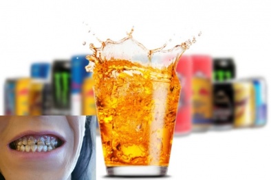 Răng bị mục nát do uống nước tăng lực trong nhiều ngày liền
