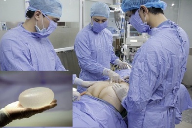 Bị ung thư di căn nghi do nâng mông thẩm mỹ chỉ sau một năm