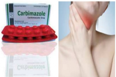 Cảnh báo thuốc carbimazole làm tăng nguy cơ dị tật bẩm sinh