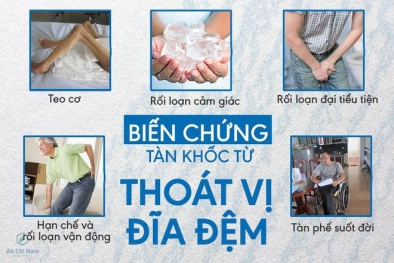 Có đến 30% dân số Việt Nam mắc thoát vị đĩa đệm