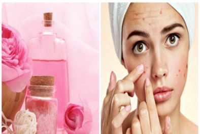 Sai lầm khi dùng nước hoa hồng khiến chị em phải 'khóc thét' vì đầy mụn