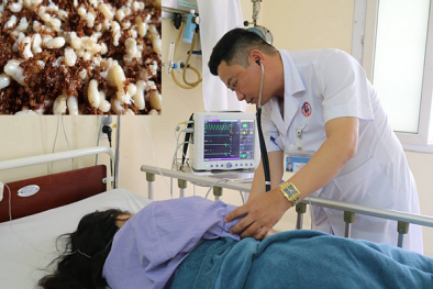 Trứng kiến chứa độc tố gì khiến người phụ nữ suýt tử vong sau khi ăn?