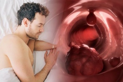 Cảnh báo nguy hiểm: Đổ mồ hôi ban đêm có thể là dấu hiệu của bệnh ung thư