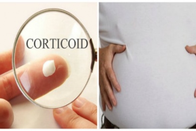 Suy kiệt, xơ gan do sử dụng thuốc chứa corticoid chữa đau lưng dài ngày