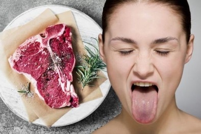 Thiếu Vitamin B12 và những triệu chứng cảnh báo