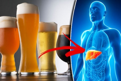Dấu hiệu cảnh báo gan bị tổn thương không bao giờ được xem nhẹ do sử dụng rượu bia