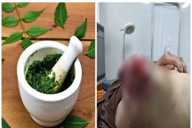 Tự ý đắp lá chữa ung thư chẳng khác nào mang thêm họa vào thân