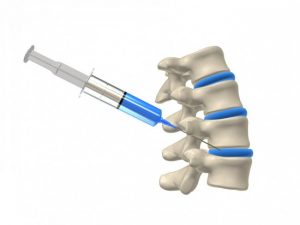 Tử vong do tiêm thuốc gây tê - những biến chứng khó lường trước