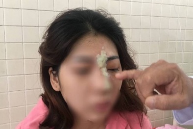 Liên tiếp các trường hợp mù mắt sau khi làm đẹp tại spa
