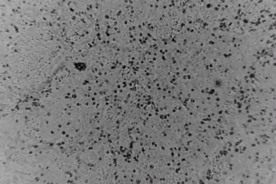 Australia: Tái tạo thành công virus Corona, giúp đẩy nhanh nghiên cứu vắc xin