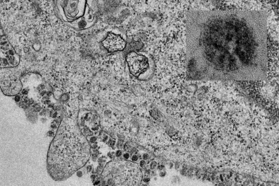 Hình ảnh virus corona phân bào vừa được phát hiện như thế nào?