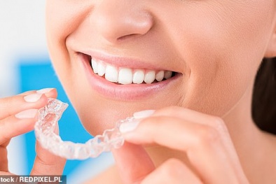 Tuyệt đối không dùng niềng răng tự làm kẻo tiền mất tật mang