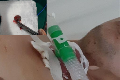 Ông bố suýt mất mạng vì hóc đồng xu khi chơi trò tung hứng với con