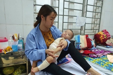 Tin lời thầy lang chữa bỏng giá 'cắt cổ' bé trai bị hoại tử da nghiêm trọng