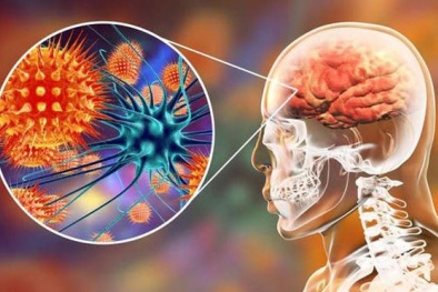 Xuất hiện loại virus có độ nguy hiểm gấp 75 lần virus corona