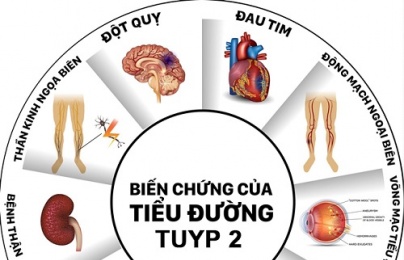 Cảnh báo căn bệnh cứ 10 giây có một người tử vong