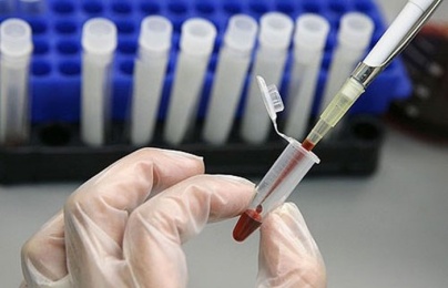 Mời công an điều tra làm rõ thông tin nghi nhiều người trong một xã ở Phú Thọ nhiễm HIV