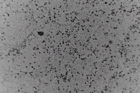 Australia: Tái tạo thành công virus Corona, giúp đẩy nhanh nghiên cứu vắc xin