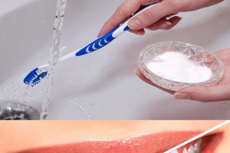 Những nguy hiểm khi dùng thuốc tẩy trắng răng giá rẻ, kém chất lượng tại nhà