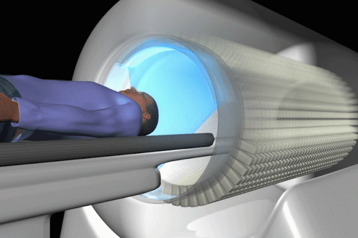 Máy phát hiện ung thư sớm bằng công nghệ quét 3D đầu tiên trên thế giới
