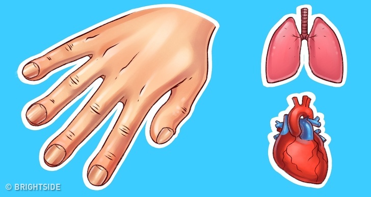  Ngón tay khẳng khiu, đốt ngón tay phát triển không đều thì có thể là do thiếu oxy hoặc mắc bệnh nguy hiểm