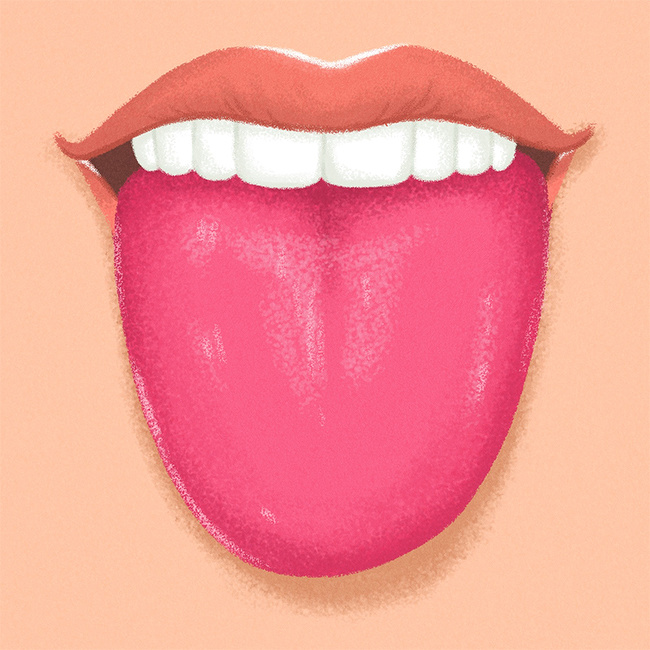 Lưỡi có màu đỏ dâu tây như thế này có thể là dấu hiệu cơ thể đang thiếu sắt hoặc vitamin 