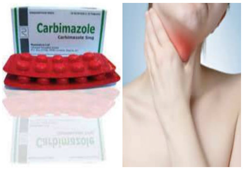 Thuốc carbimazole điều trị tuyến giáp có thể gây dị tật bẩm sinh ở thai nhi nếu sử dụng ở 3 tháng đầu thai kỳ
