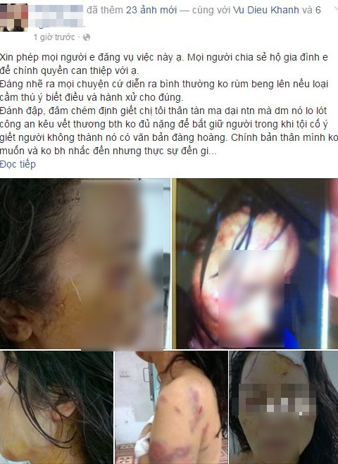 rên mạng xã hội nickname H.N đã đăng tải những hình ảnh của một người phụ nữ được cho là bị chồng cũ đánh đập